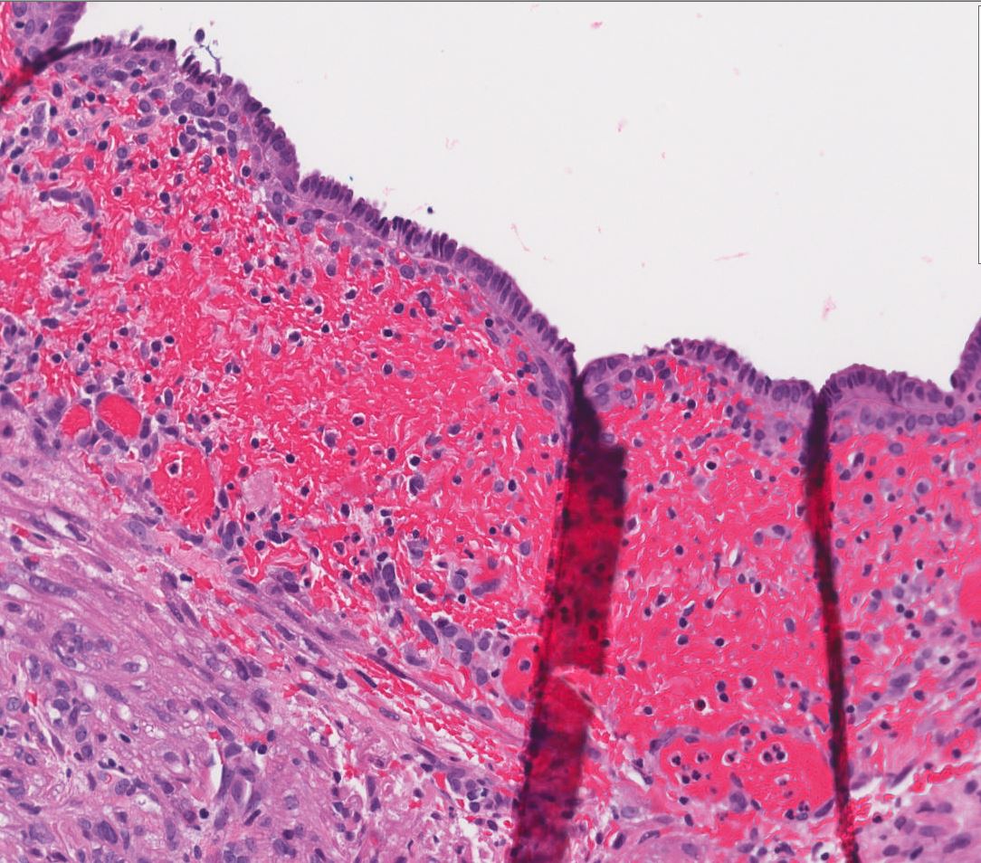 001 | Classification of renal tumors